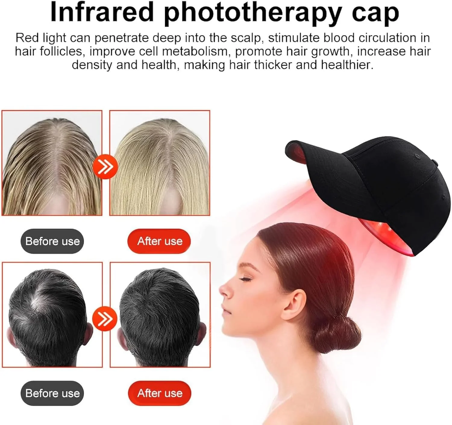 کلاه رشد مو با نور قرمز، کلاه درمان با نور قرمز LED با 82 لامپ LED، طول موج دوگانه 630 نانومتر و 650 نانومتر، احیای پوست سر، موهای ضخیم تر و پرتر برای فولیکول مو