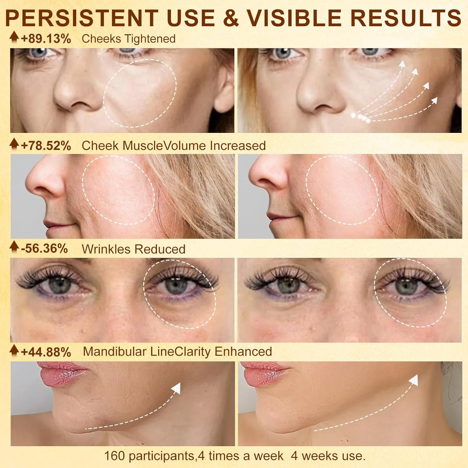 دستگاه میکر current صورت، دستگاه آر اف سفت کننده پوست برای درمان چروک های صورت و التهاب خفیف تا متوسط