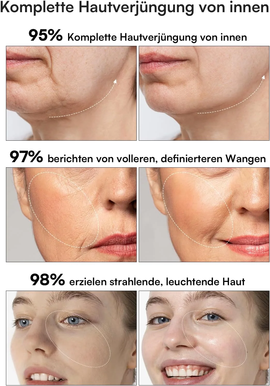 دستگاه لیفت صورت میکروکارنت INIA، دستگاه جوانسازی و سفت کننده پوست با نور قرمز 3 در 1 برای صورت و گردن، ماساژور صورت برای درخشندگی و زیبایی واقعی، کاهش موثر چین و چروک و پف