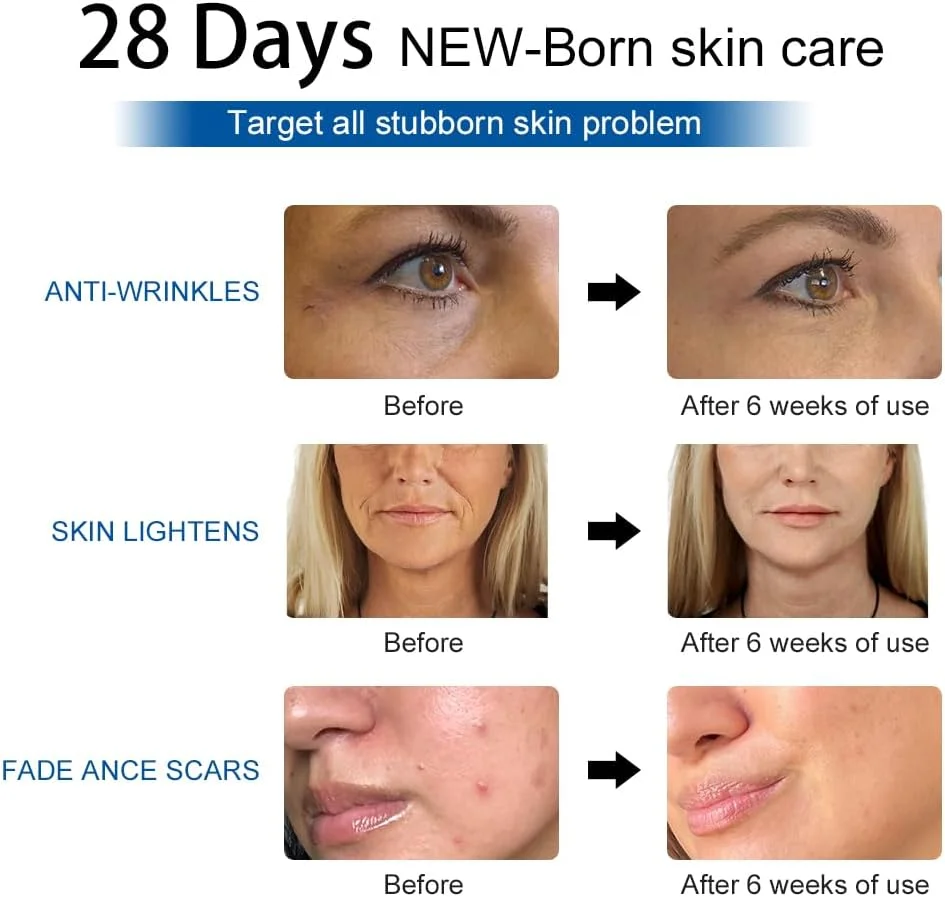 ماسک نوردرمانی قرمز LESCOLTON، 573 LED نوردرمانی قرمز برای بدن، ماسک نوردرمانی 7 رنگ LED برای جوانسازی پوست