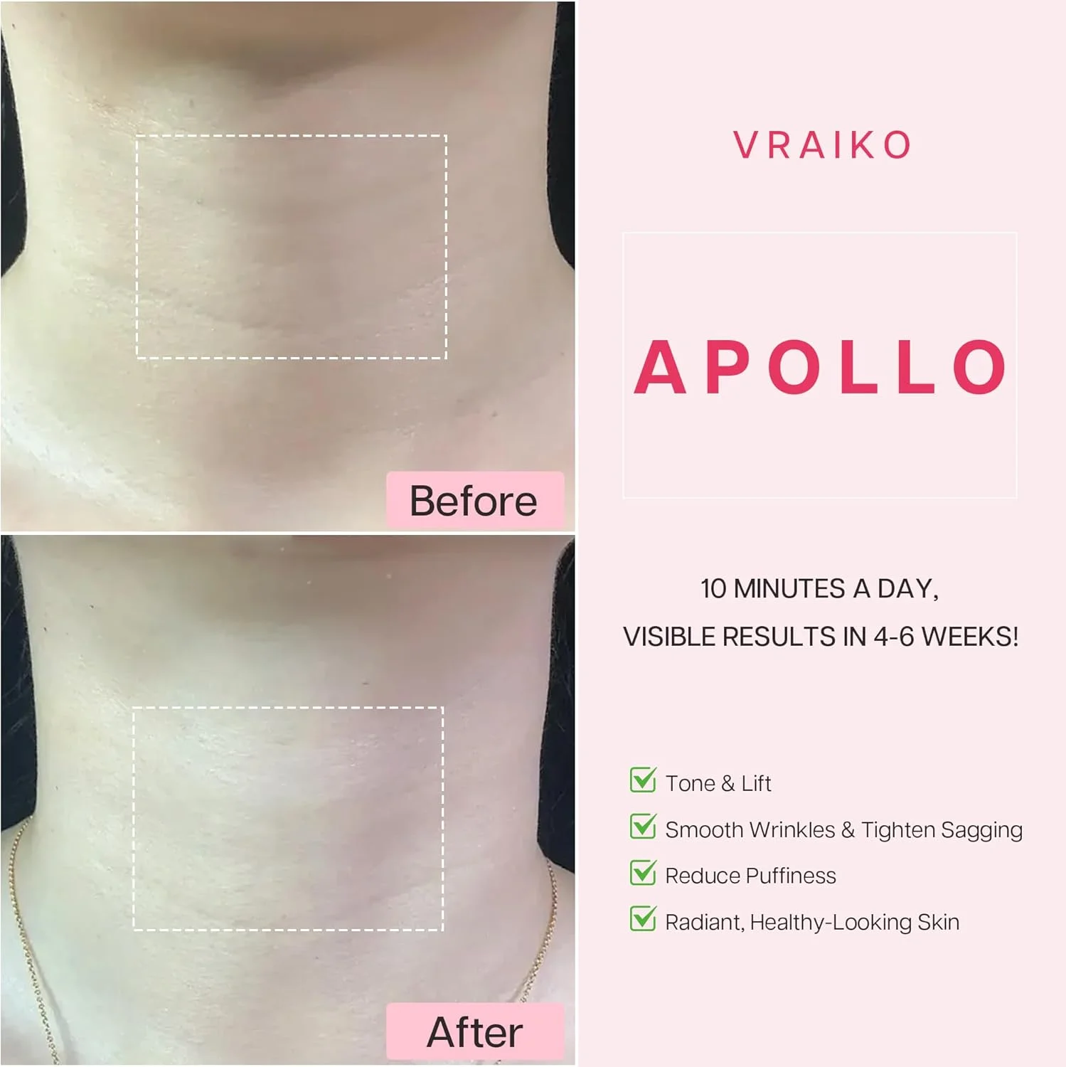 ماساژور گردن و لیفتینگ صورت VRAIKO APOLLO، دستگاه مجسمه سازی صورت و گردن با جریان میکرو و مراقبت LED دوگانه، ضد آب IP65، برای کانتورینگ، افزایش جذب، درخشندگی و کشسانی ماساژور گردن و لیفتینگ صورت VRAIKO APOLLO، دستگاه مجسمه سازی صورت و گردن با جریان میکرو و مراقبت LED دوگانه، ضد آب IP65، برای کانتورینگ، افزایش جذب، درخشندگی و کشسانی