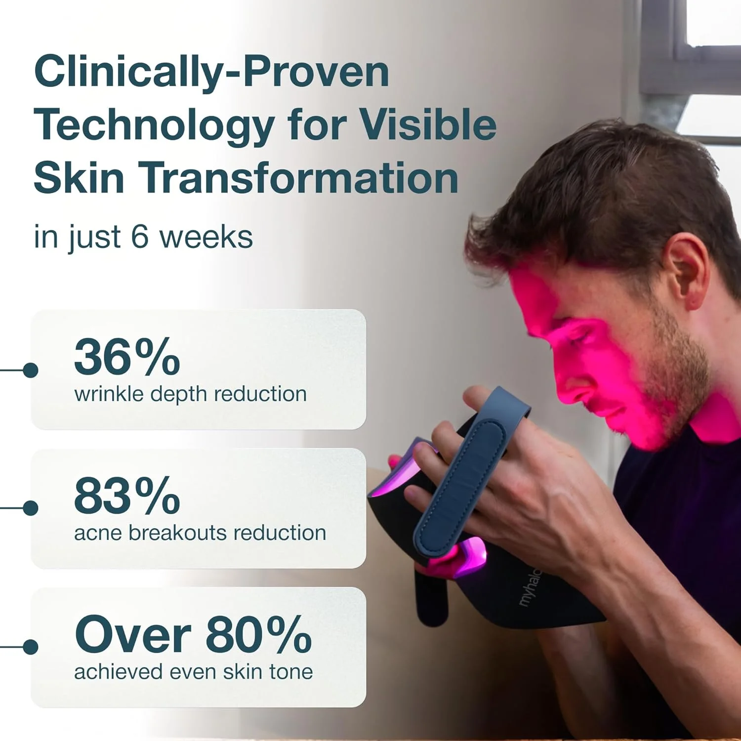 ماسک نور درمانی LED صورت myhalos - ماسک نور درمانی قرمز برای چین و چروک، لک ها و ضد پیری - ماسک نور درمانی LED حرفه ای صورت برای جوانسازی پوست - بی سیم با نور مادون قرمز و آبی