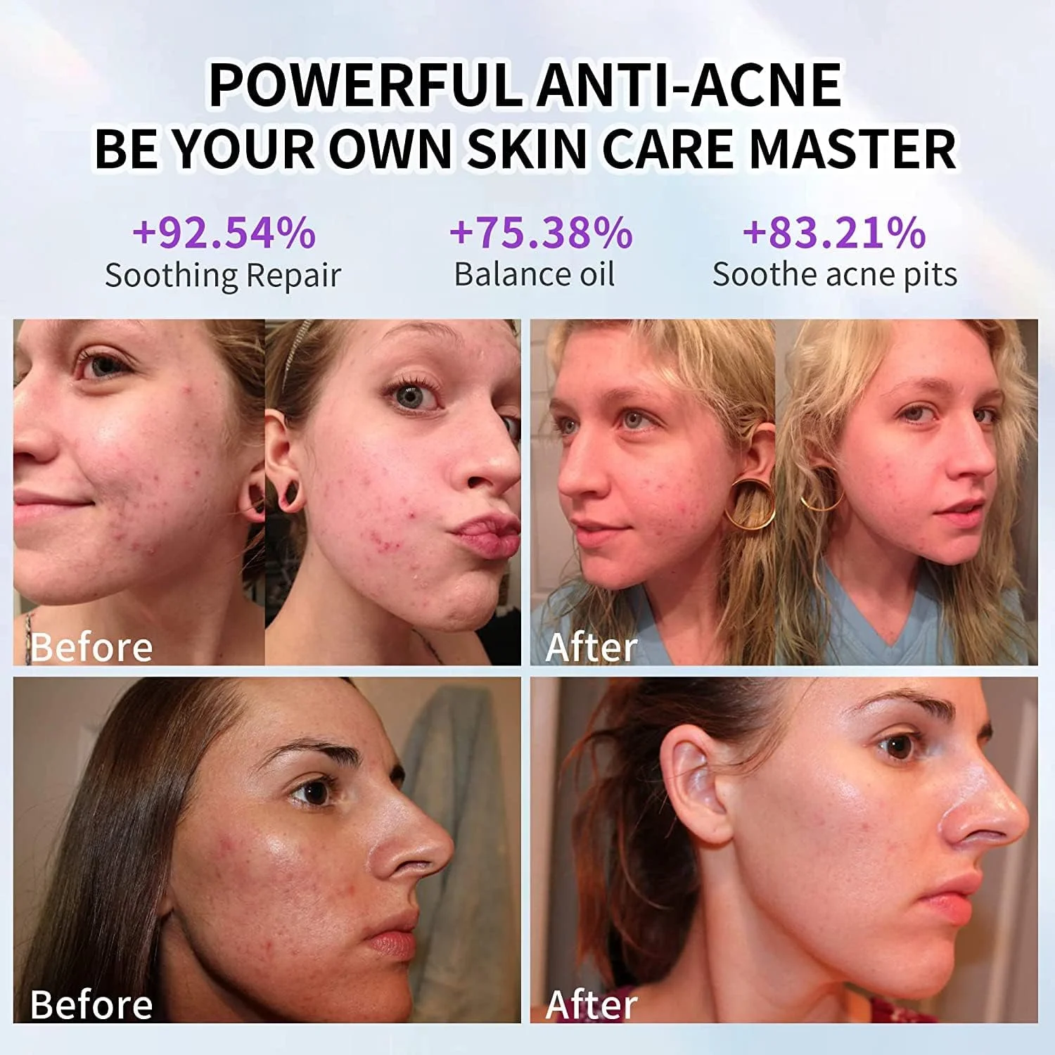 دستگاه نور درمانی صورت LED آراولی امگا PDT، سفید کننده صورت، تجهیزات زیبایی مراقبت از پوست و جوانسازی دستگاه نور درمانی صورت LED آراولی امگا PDT، سفید کننده صورت، تجهیزات زیبایی مراقبت از پوست و جوانسازی