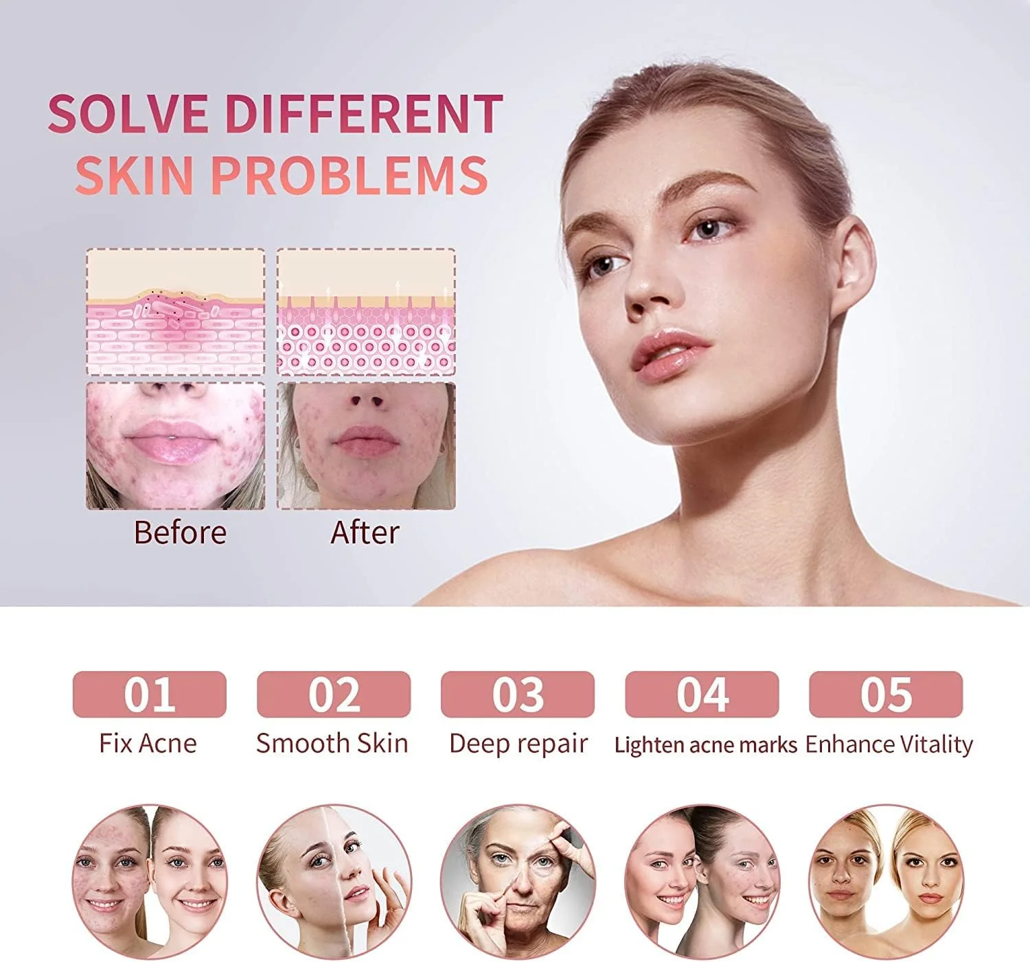 دستگاه نور درمانی صورت LED آراولی امگا PDT، سفید کننده صورت، تجهیزات زیبایی مراقبت از پوست و جوانسازی دستگاه نور درمانی صورت LED آراولی امگا PDT، سفید کننده صورت، تجهیزات زیبایی مراقبت از پوست و جوانسازی