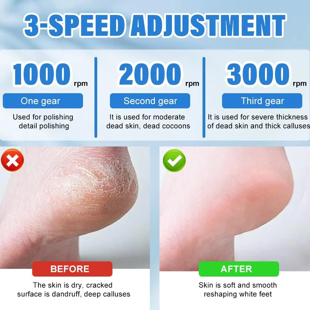 دستگاه الکتریکی از بین برنده پینه پا با 2 سری سنگ زنی استیل ضد زنگ، دستگاه مراقبت از پا قابل شارژ با نمایشگر LED، 3 سرعت، سوهان پینه باتری برای مقابله با پینه های قوی و پوست ترک خورده دستگاه الکتریکی از بین برنده پینه پا با 2 سری سنگ زنی استیل ضد زنگ، دستگاه مراقبت از پا قابل شارژ با نمایشگر LED، 3 سرعت، سوهان پینه باتری برای مقابله با پینه های قوی و پوست ترک خورده