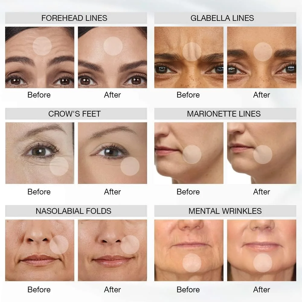 ماسک نوردرمانی ال ای دی RegenaLight برای صورت، ماسک نوردرمانی صورت ال ای دی 7 رنگ، ماسک زیبایی مراقبت از پوست فوتون در خانه برای کاهش آکنه و چین و چروک ماسک نوردرمانی ال ای دی RegenaLight برای صورت، ماسک نوردرمانی صورت ال ای دی 7 رنگ، ماسک زیبایی مراقبت از پوست فوتون در خانه برای کاهش آکنه و چین و چروک