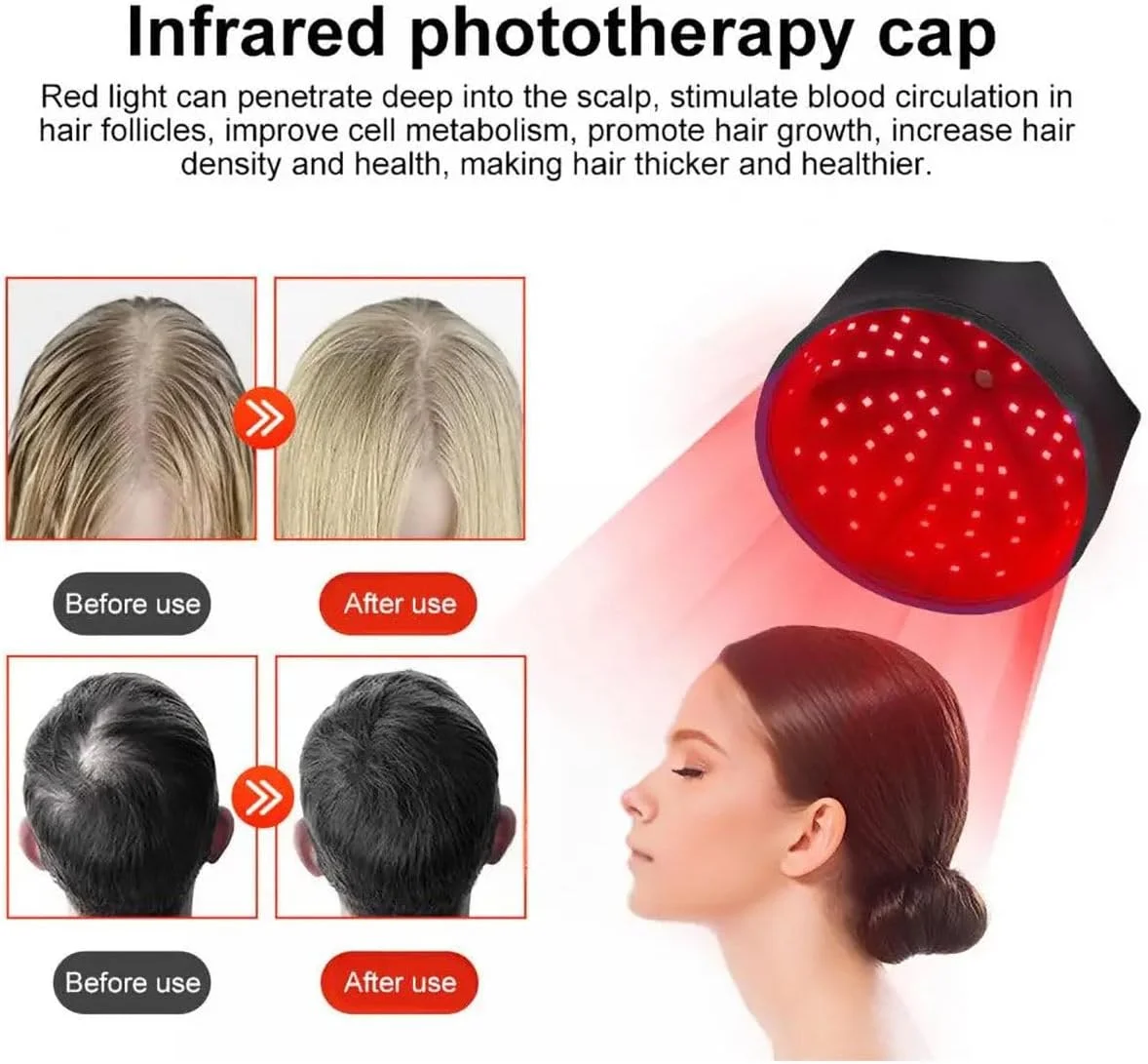 کلاه درمان با نور قرمز برای رشد مو، کلاه فوتوتراپی با طول موج دوگانه 660 نانومتر و 850 نانومتر با 120 ال ای دی برای مردان و زنان، بهبود سلامت پوست سر و کاهش شوره سر، خاکستری