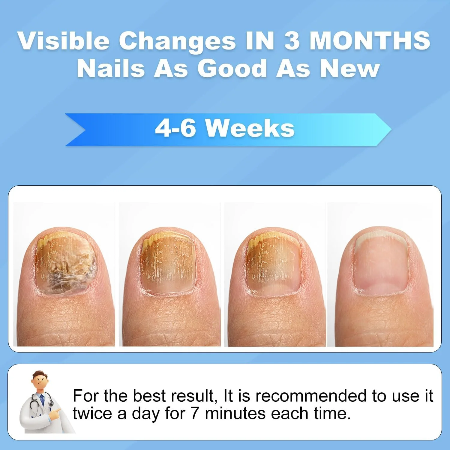 دستگاه درمان قارچ ناخن، دستگاه نور LED لیزری درمان قارچ ناخن، نور پاک کننده قارچ برای ناخن های ضخیم دست و پا، دستگاه قابل شارژ حذف قارچ ناخن برای استفاده خانگی، سفید دستگاه درمان قارچ ناخن، دستگاه نور LED لیزری درمان قارچ ناخن، نور پاک کننده قارچ برای ناخن های ضخیم دست و پا، دستگاه قابل شارژ حذف قارچ ناخن برای استفاده خانگی، سفید