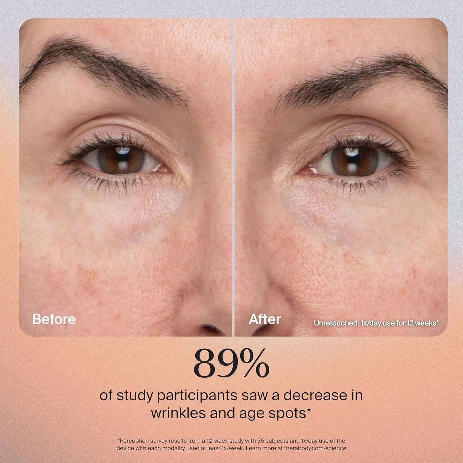 دستگاه ماساژ صورت دستی TheraFace PRO - ابزار درمانی فشرده برقی مراقبت از پوست و صورت - درمان 8 در 1 با حلقه های نور LED و میکروکارنت برای زیبایی شخصی نهایی، سفید