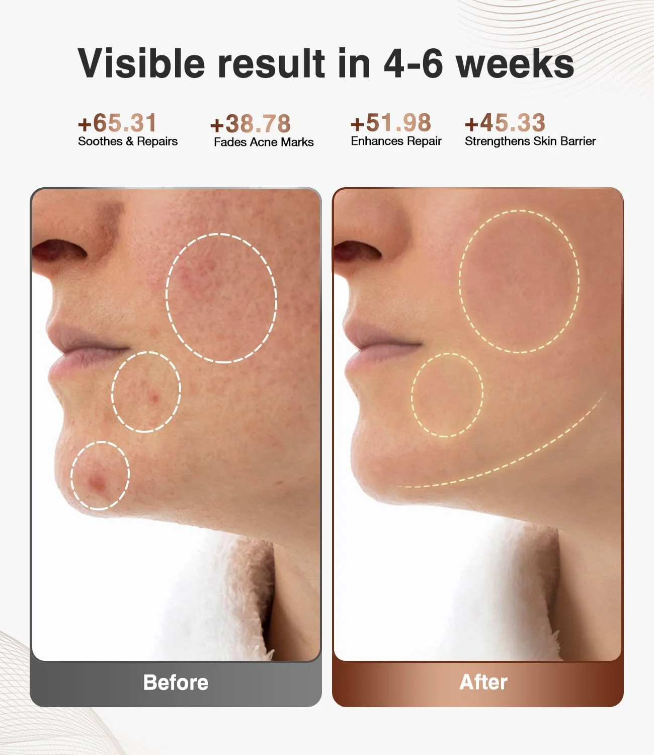 دستگاه نوردرمانی قرمز JOVS برای زیبایی صورت با نور LED، دارای 4 حالت و ابزار مراقبت از پوست قابل حمل برای استفاده در منزل