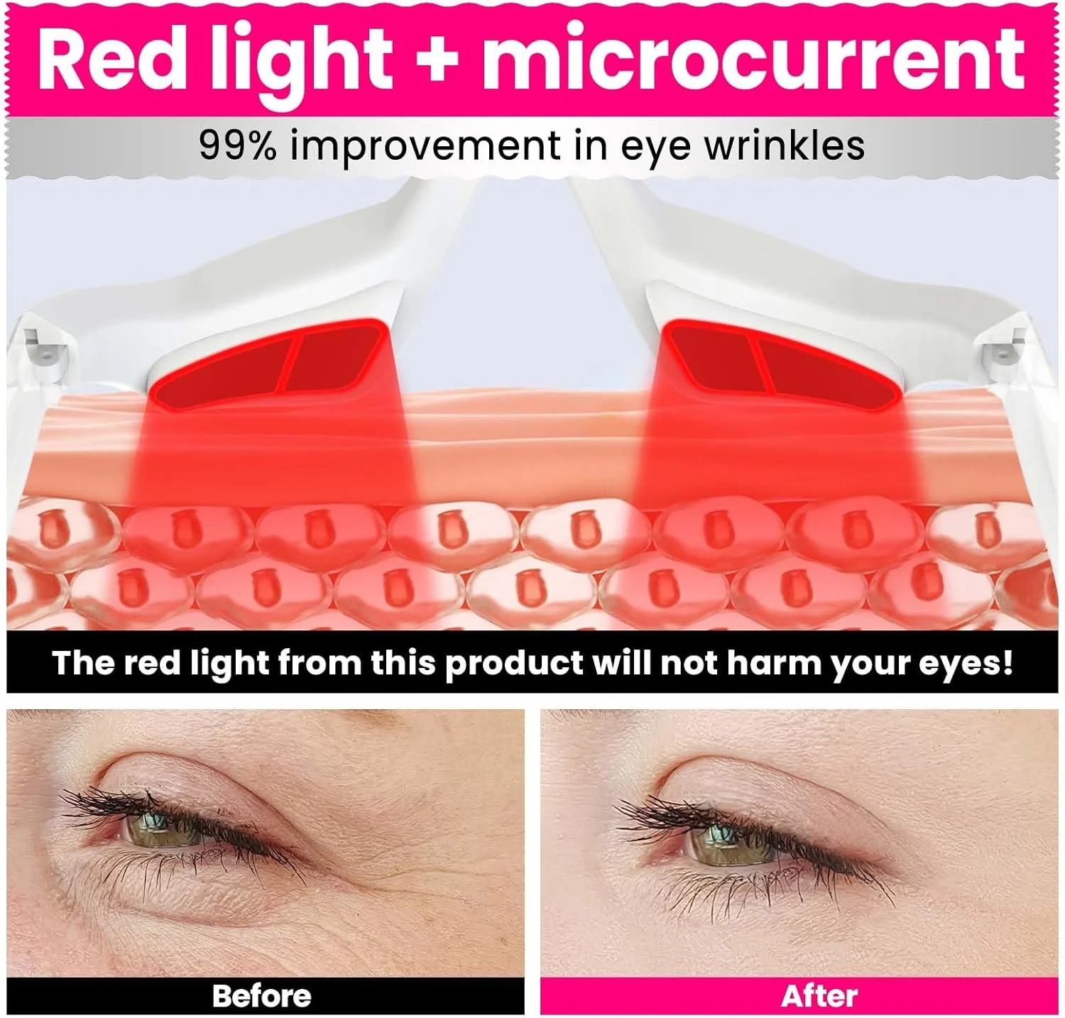 عینک تراپی نور قرمز برای رفع چروک، ماساژور چشم، دستگاه میکر current صورت، مورد استفاده برای رفع چروک های چشم، رفع خستگی چشم و رفع سیاهی دور چشم. دستگاه LED بهبود دهنده چشم (مدل: EY-36A) عینک تراپی نور قرمز برای رفع چروک، ماساژور چشم، دستگاه میکر current صورت، مورد استفاده برای رفع چروک های چشم، رفع خستگی چشم و رفع سیاهی دور چشم. دستگاه LED بهبود دهنده چشم (مدل: EY-36A)