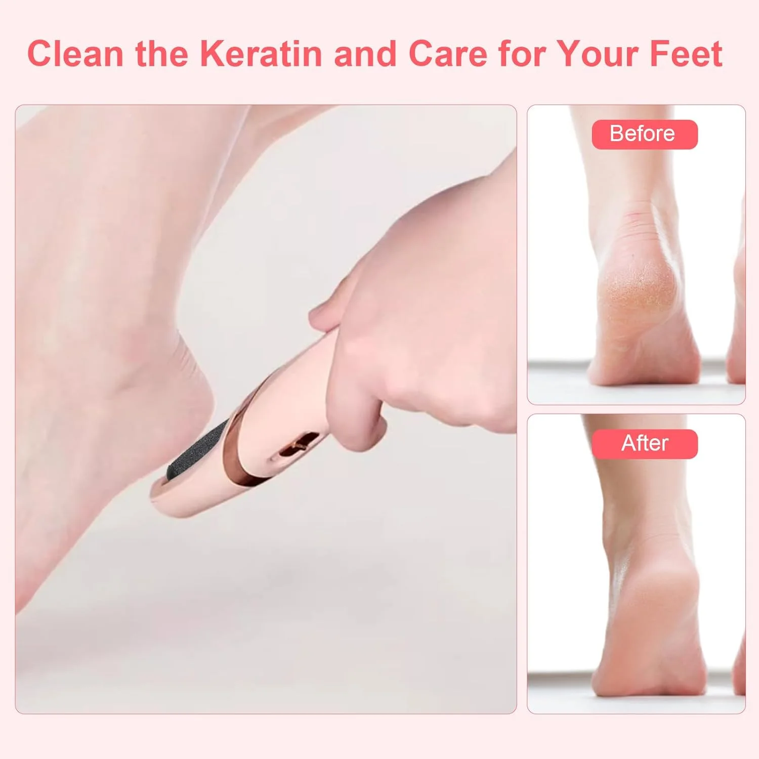 سر یدکی دستگاه سوهان برقی پا Zerone، بسته 10 عددی، سری غلتکی زبر و نرم، لوازم جانبی برای مراقبت شخصی و از بین بردن پینه پا