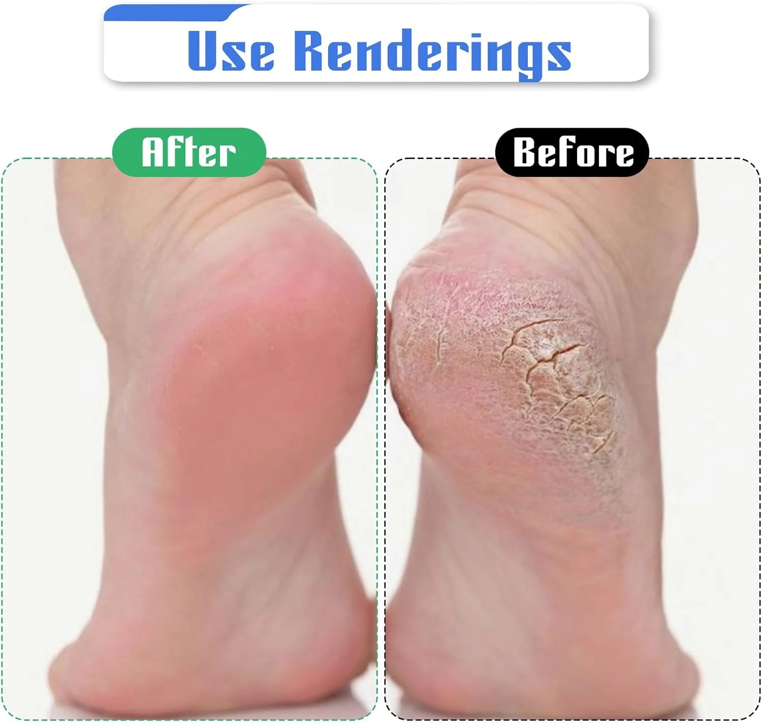 6 عدد سری یدکی پدیکور، غلتک های سوهان ابزار برقی، سری غلتکی یدکی زبر، ابزار سوهان پدیکور، مراقبت از پا برای مردان و زنان، از بین برنده پینه