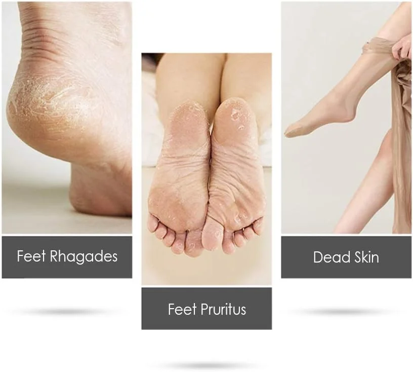 دستگاه پدیکور سانین، سوهان برقی پا با سری غلتکی، باطری خور، قابل حمل، ابزار پدیکور، اسکرابر پا، از بین برنده پینه برای پوست های مرده، سفت، ترک خورده و خشک دستگاه پدیکور سانین، سوهان برقی پا با سری غلتکی، باطری خور، قابل حمل، ابزار پدیکور، اسکرابر پا، از بین برنده پینه برای پوست های مرده، سفت، ترک خورده و خشک