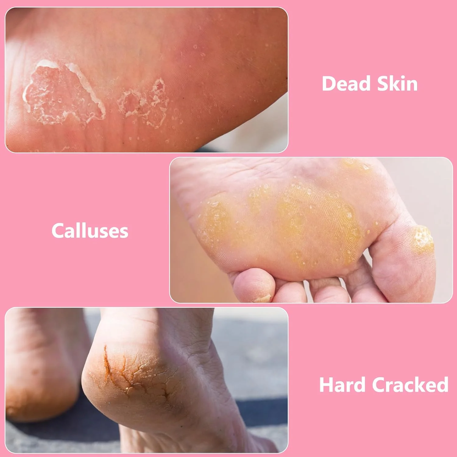 سوهان پا OWIIZI، اسکرابر پدیکور پا برای از بین بردن پینه، لایه بردار استیل ضد زنگ پا، رنده خراشنده پا، از بین برنده پوست های مرده و ترک خورده برای پای خشک و مرطوب سوهان پا OWIIZI، اسکرابر پدیکور پا برای از بین بردن پینه، لایه بردار استیل ضد زنگ پا، رنده خراشنده پا، از بین برنده پوست های مرده و ترک خورده برای پای خشک و مرطوب