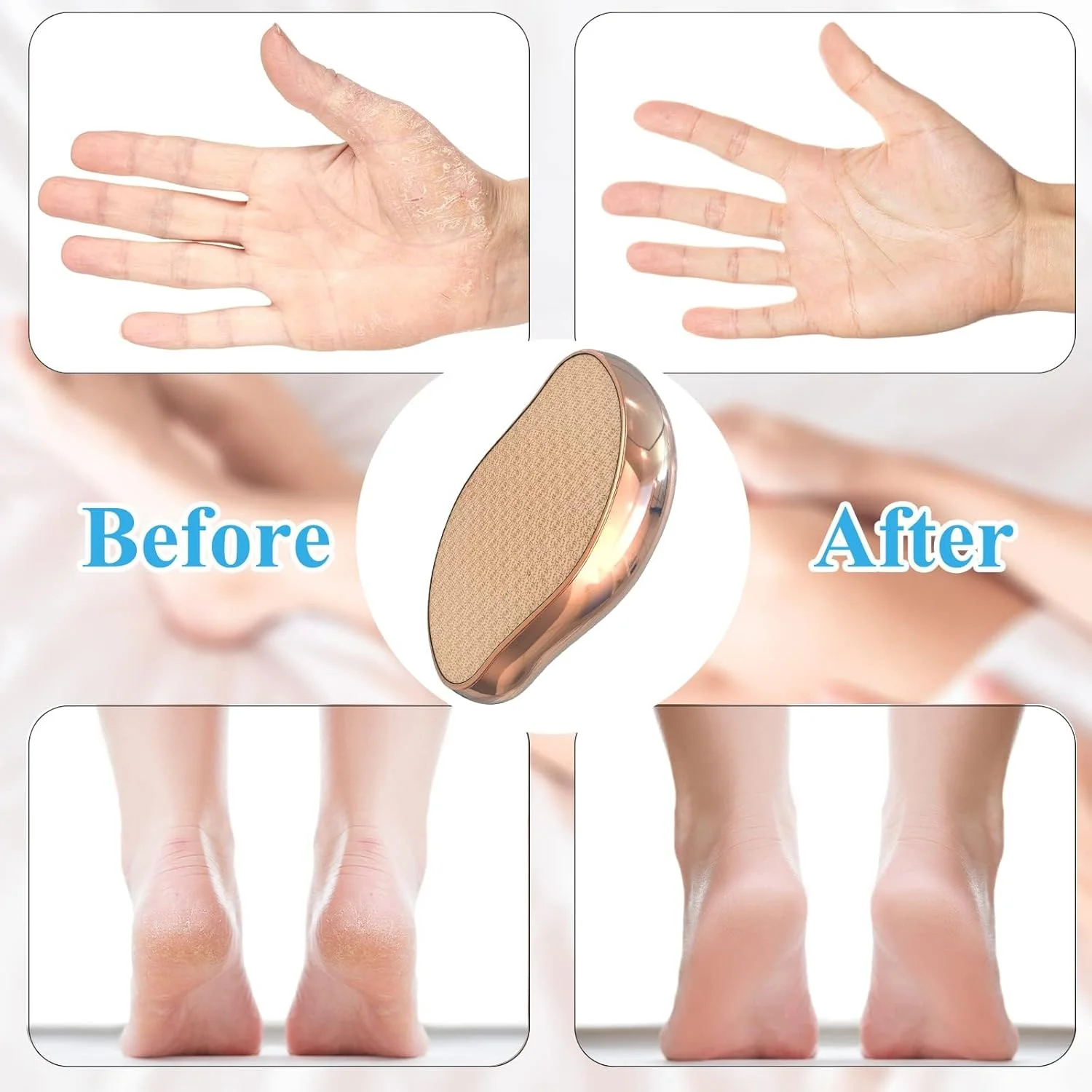 سوهان کریستالی پا، از بین برنده پینه و پوست مرده - ابزار پدیکور برای استفاده خشک/مرطوب، به طور موثر پوست مرده و پینه ها را با طراحی ارگونومیک از بین می برد سوهان کریستالی پا، از بین برنده پینه و پوست مرده - ابزار پدیکور برای استفاده خشک/مرطوب، به طور موثر پوست مرده و پینه ها را با طراحی ارگونومیک از بین می برد