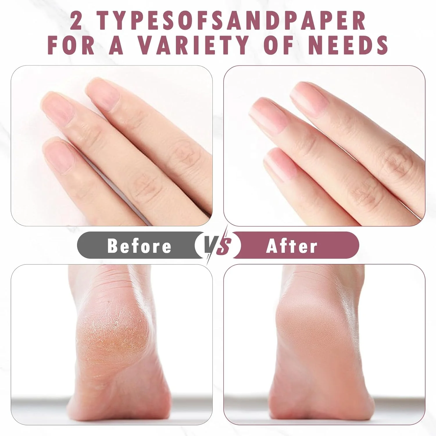 سوهان برقی پا، از بین برنده پینه پا، ابزار حرفه ای پدیکور پا با 60 عدد کاغذ سنباده جایگزین، جهت قابل تنظیم، از بین بردن پوست مرده (صورتی) سوهان برقی پا، از بین برنده پینه پا، ابزار حرفه ای پدیکور پا با 60 عدد کاغذ سنباده جایگزین، جهت قابل تنظیم، از بین بردن پوست مرده (صورتی)