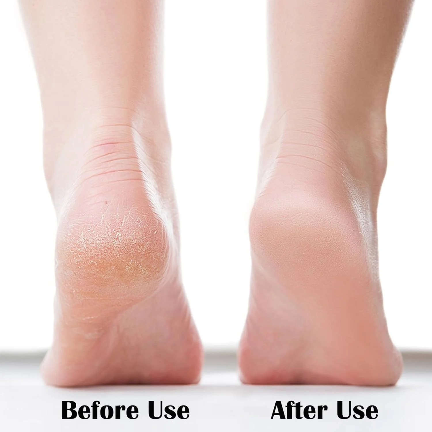 سوهان نانو پا، اسکرابر پا از بین برنده پینه، ابزار پدیکور مراقبت از پا، سوهان پا با نقاط سنگ زنی نانو، اسکرابر قابل حمل پا برای از بین بردن پوست مرده، ترک خوردگی، پاهای خیس و خشک