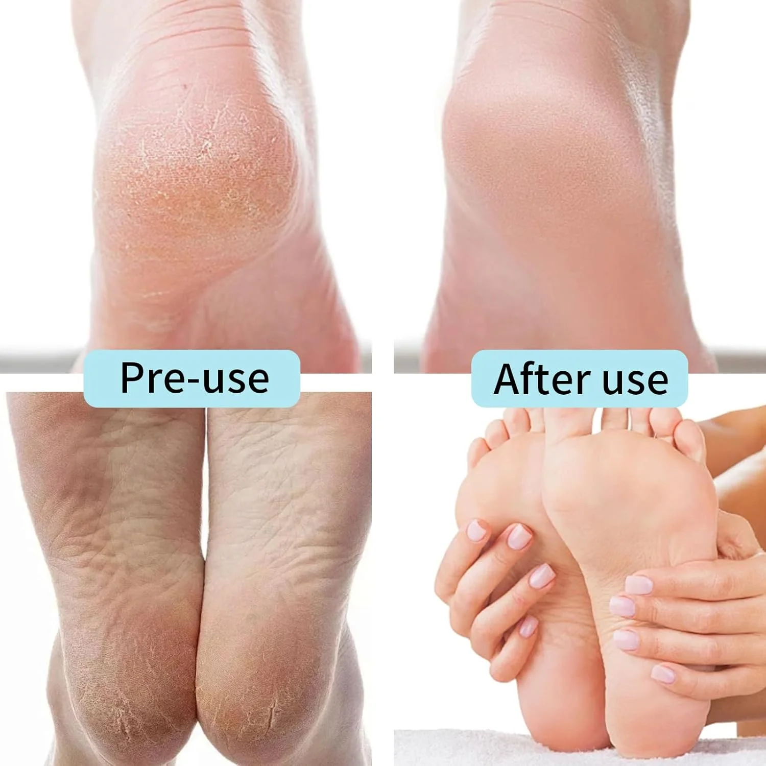 مجموعه 3 عددی سوهان پا، اسکرابر پا و تراشنده - ابزار مراقبت از پا از جنس استیل ضد زنگ - از بین برنده پوست سخت پدیکور و تیغ اصلاح پوست مرده دست