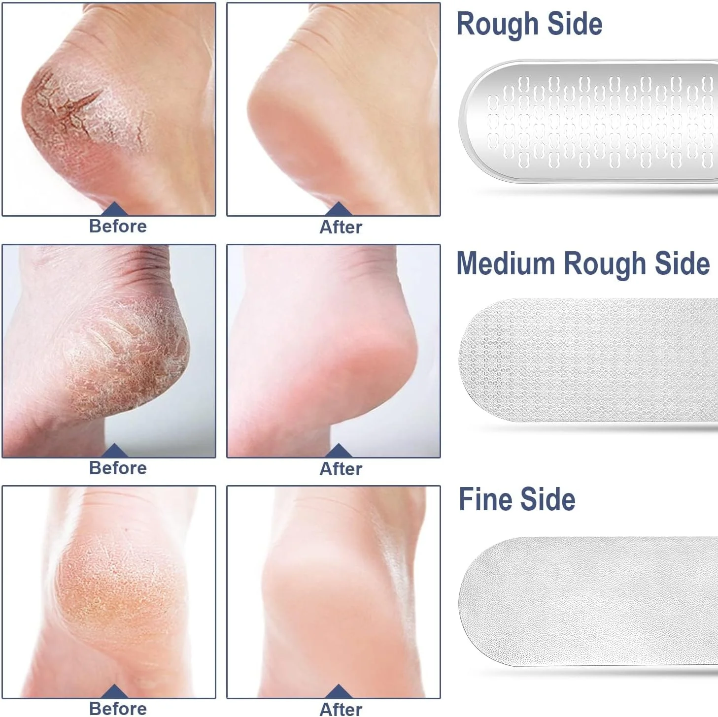 سوهان پا تاشو KASTWAVE، اسکرابر حرفه ای پا از جنس استیل ضد زنگ 3 در 1، قابل استفاده به صورت خشک و مرطوب، حمل آسان، مشکی