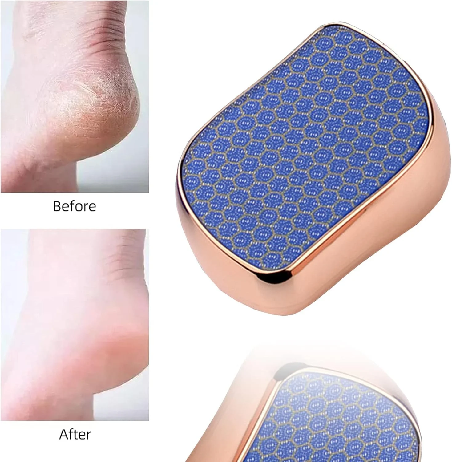 سوهان پدیکور شیشه ای نانو متراکم KASTWAVE - ابزار موثر پدیکور برای پوست سخت، از بین بردن پینه و مراقبت از پا برای آقایان و بانوان (1 عدد)