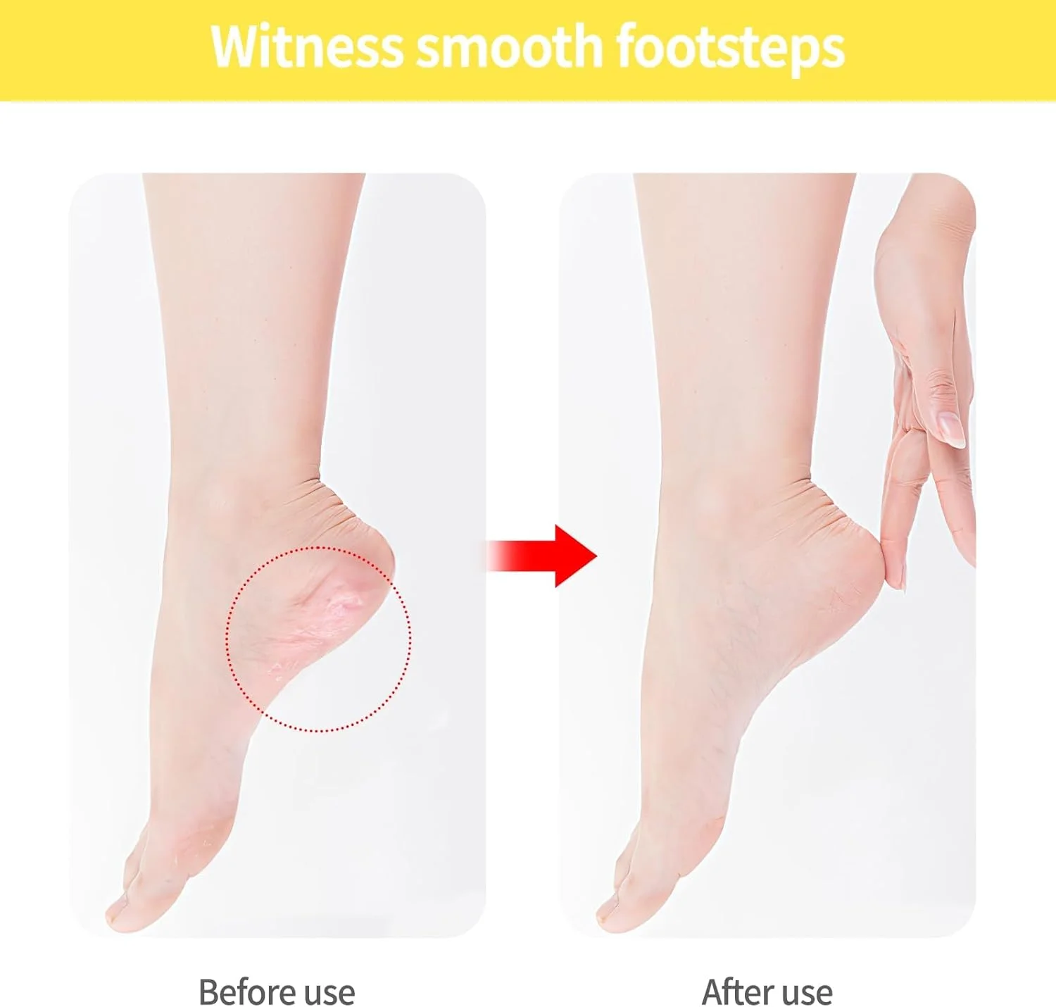 ست سوهان پای استیل ضد زنگ، مجموعه 8 عددی ابزار پدیکور دو طرفه قابل حمل، سوهان پا، اسکرابر و خراشنده پا، ابزار مراقبت از پا در منزل برای پوست سخت، از بین بردن پینه و ترک پاشنه پا، زرد ست سوهان پای استیل ضد زنگ، مجموعه 8 عددی ابزار پدیکور دو طرفه قابل حمل، سوهان پا، اسکرابر و خراشنده پا، ابزار مراقبت از پا در منزل برای پوست سخت، از بین بردن پینه و ترک پاشنه پا، زرد