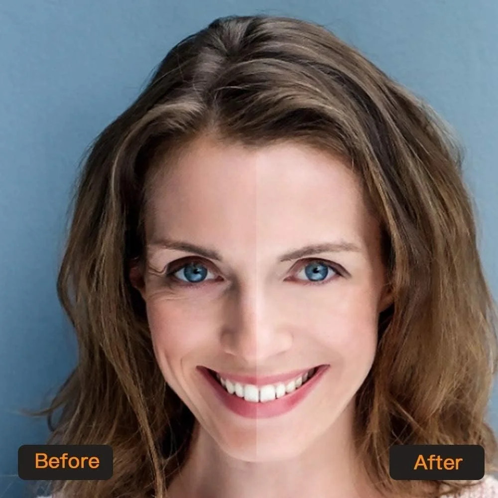 ماسک های درمان زیر چشم، پچ های زیر چشم کلاژن ژل طبیعی طلای 24 عیار، ماسک چشم برای حلقه های تیره، رفع پف و سیاهی زیر چشم، ضد چروک، آبرسان، تسکین دهنده (20 جفت)