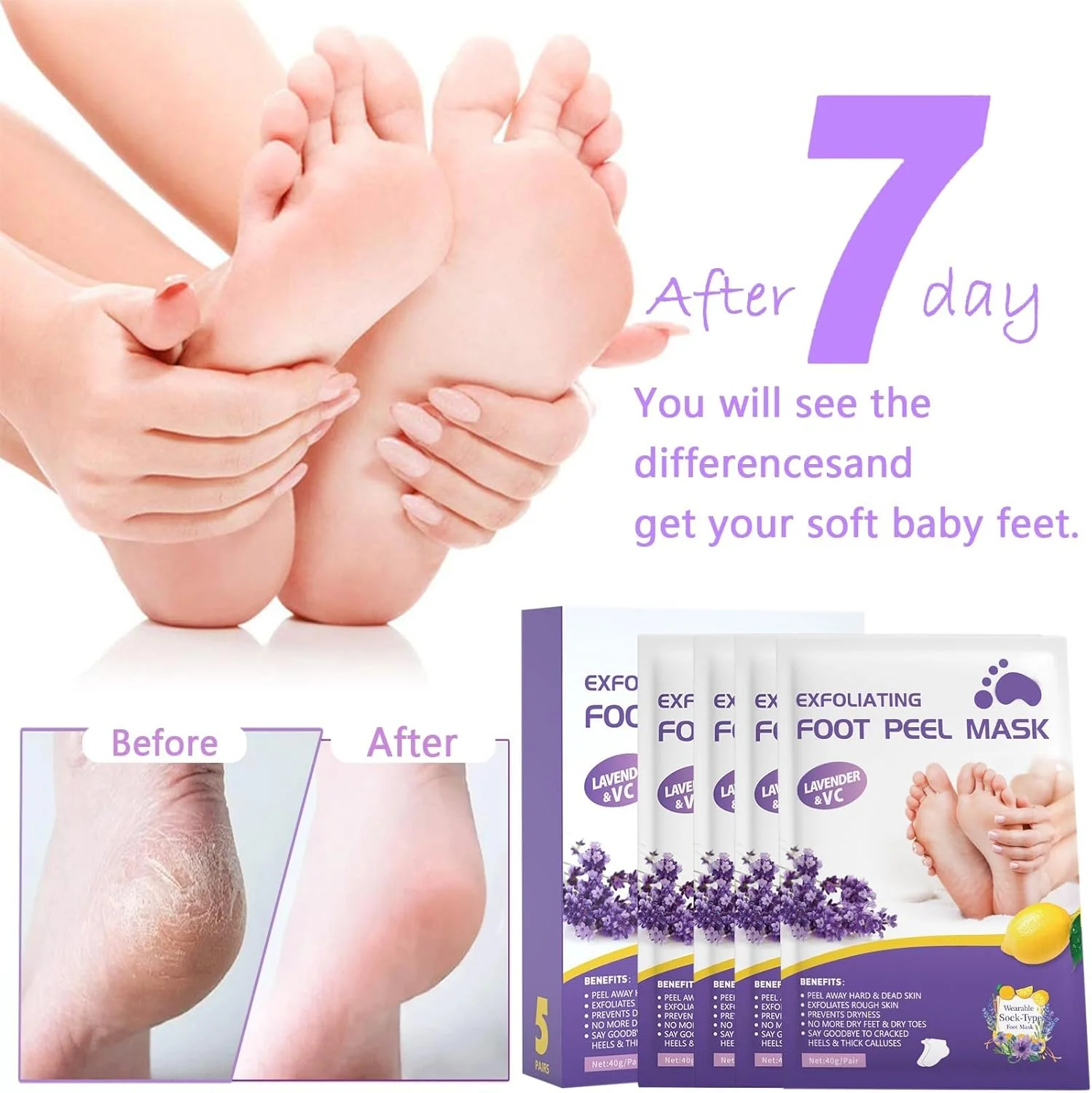 ۵ جفت ماسک لایه بردار پا، ماسک ژلی لایه بردار پا برای خشکی و ترک خوردگی، پینه، از بین بردن پوست مرده پا، ترمیم کلاژن غنی پاشنه های زبر، لمس نرم و صاف، ست هدیه مراقبت از پا مرطوب کننده