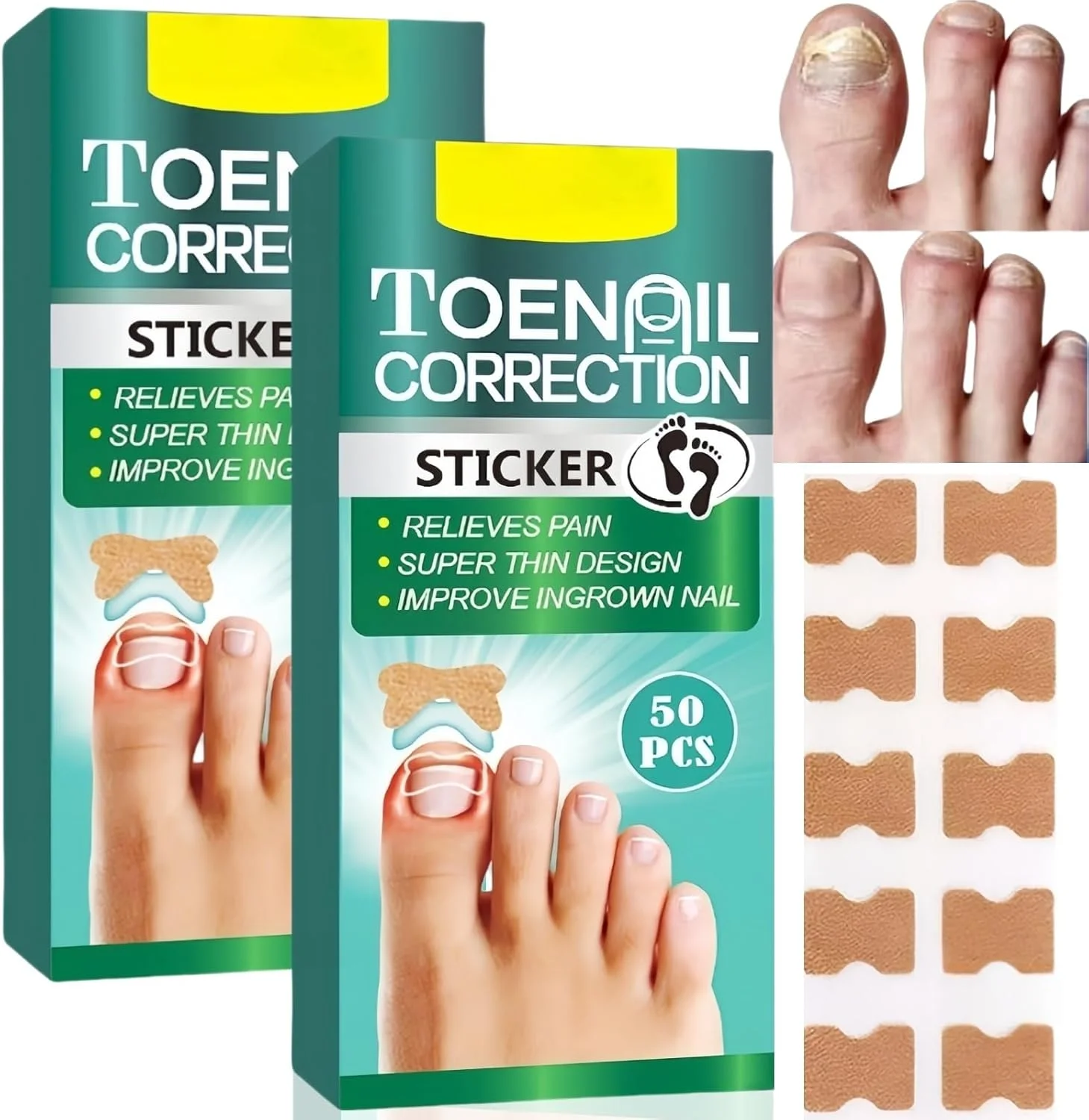 ۵۰ عدد پد اصلاح ناخن فرورفته، برچسب اصلاح ناخن، ابزار اصلاح ناخن فرورفته، برچسب های ناخن پا بدون درد برای مراقبت از ناخن پا، برچسب های ناخن پا برای ترمیم ناخن سالم