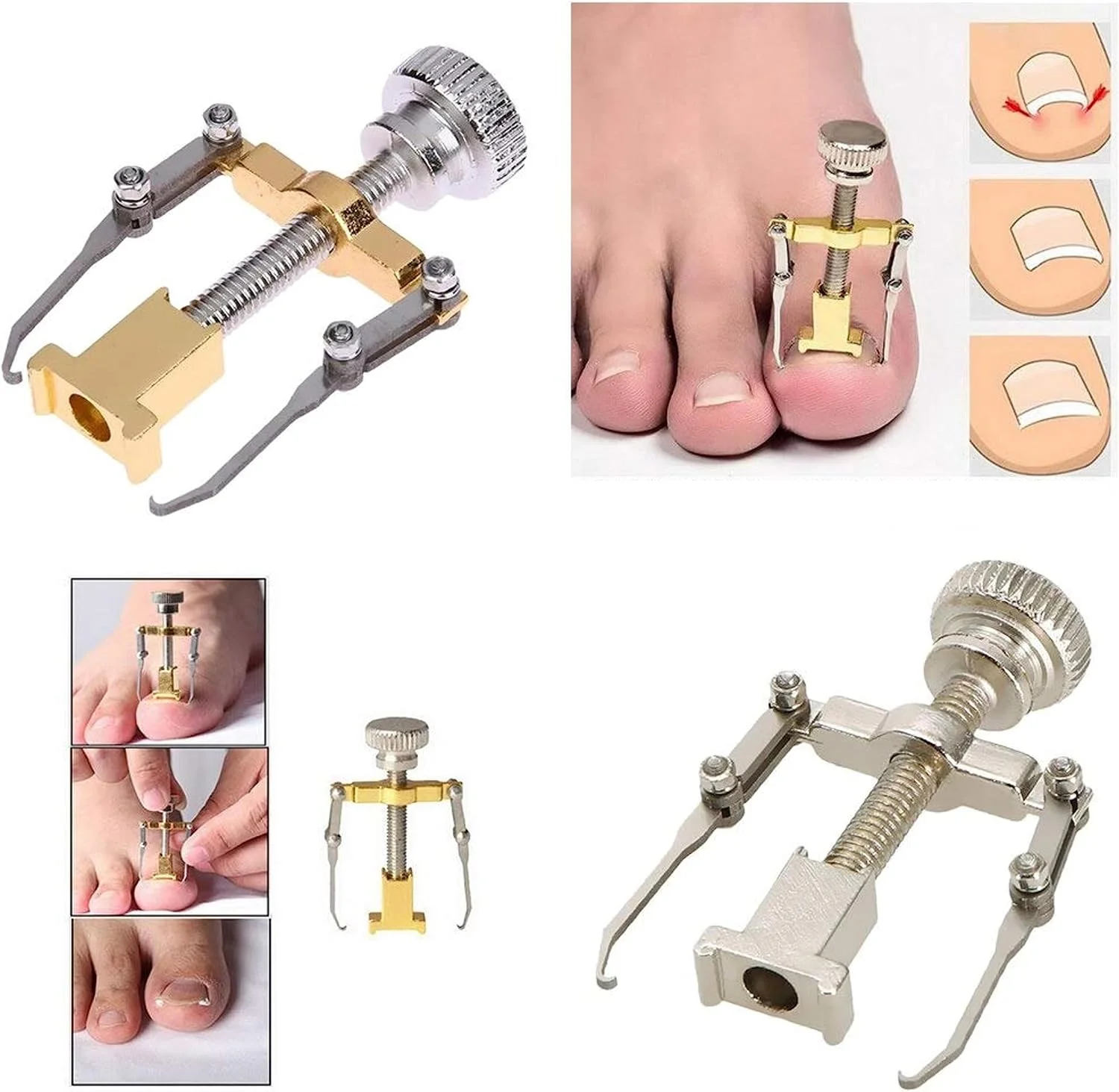 مجموعه 2 عددی ابزار اصلاح ناخن پا فرورفته، اصلاح کننده ناخن پا، مراقبت از ناخن پا مجموعه 2 عددی ابزار اصلاح ناخن پا فرورفته، اصلاح کننده ناخن پا، مراقبت از ناخن پا