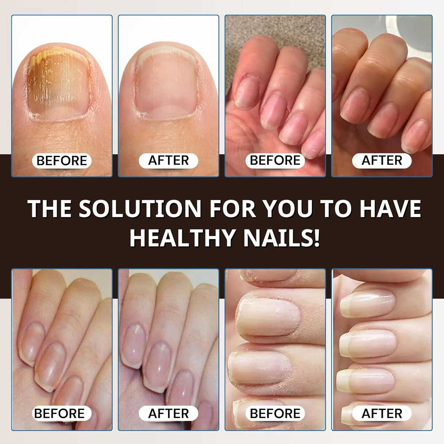 قطره های ترمیم کننده ناخن آبرا کمبو پریمیوم - پشتیبانی مغذی برای ناخن های ضعیف، لکه دار و بدشکل قطره های ترمیم کننده ناخن آبرا کمبو پریمیوم - پشتیبانی مغذی برای ناخن های ضعیف، لکه دار و بدشکل