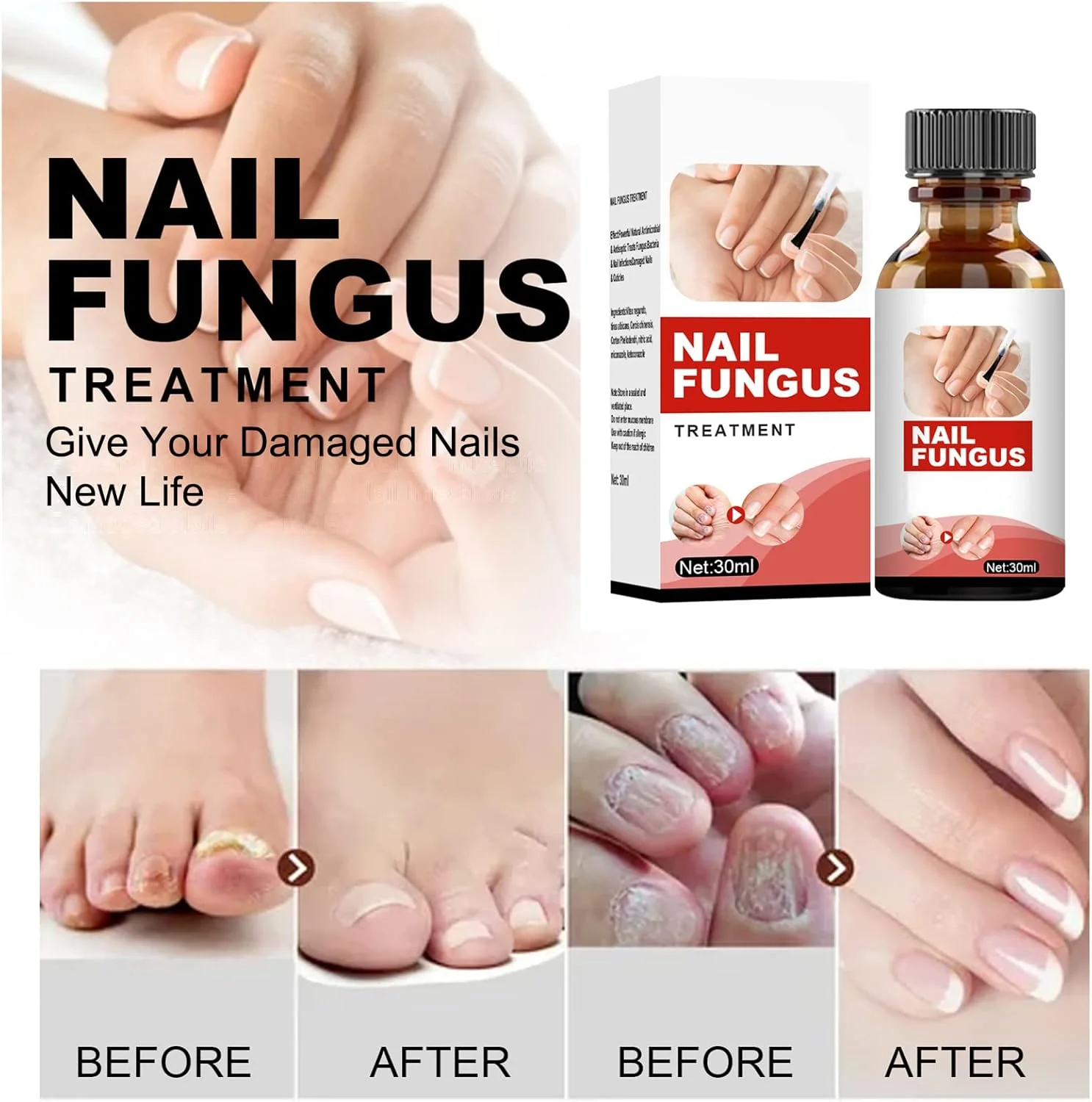 محلول درمان قارچ ناخن پا، درمان ضد قارچی ناخن پا، کیت ترمیم ناخن، محلول قارچ ناخن، ایمن و موثر 30 میلی لیتر محلول درمان قارچ ناخن پا، درمان ضد قارچی ناخن پا، کیت ترمیم ناخن، محلول قارچ ناخن، ایمن و موثر 30 میلی لیتر