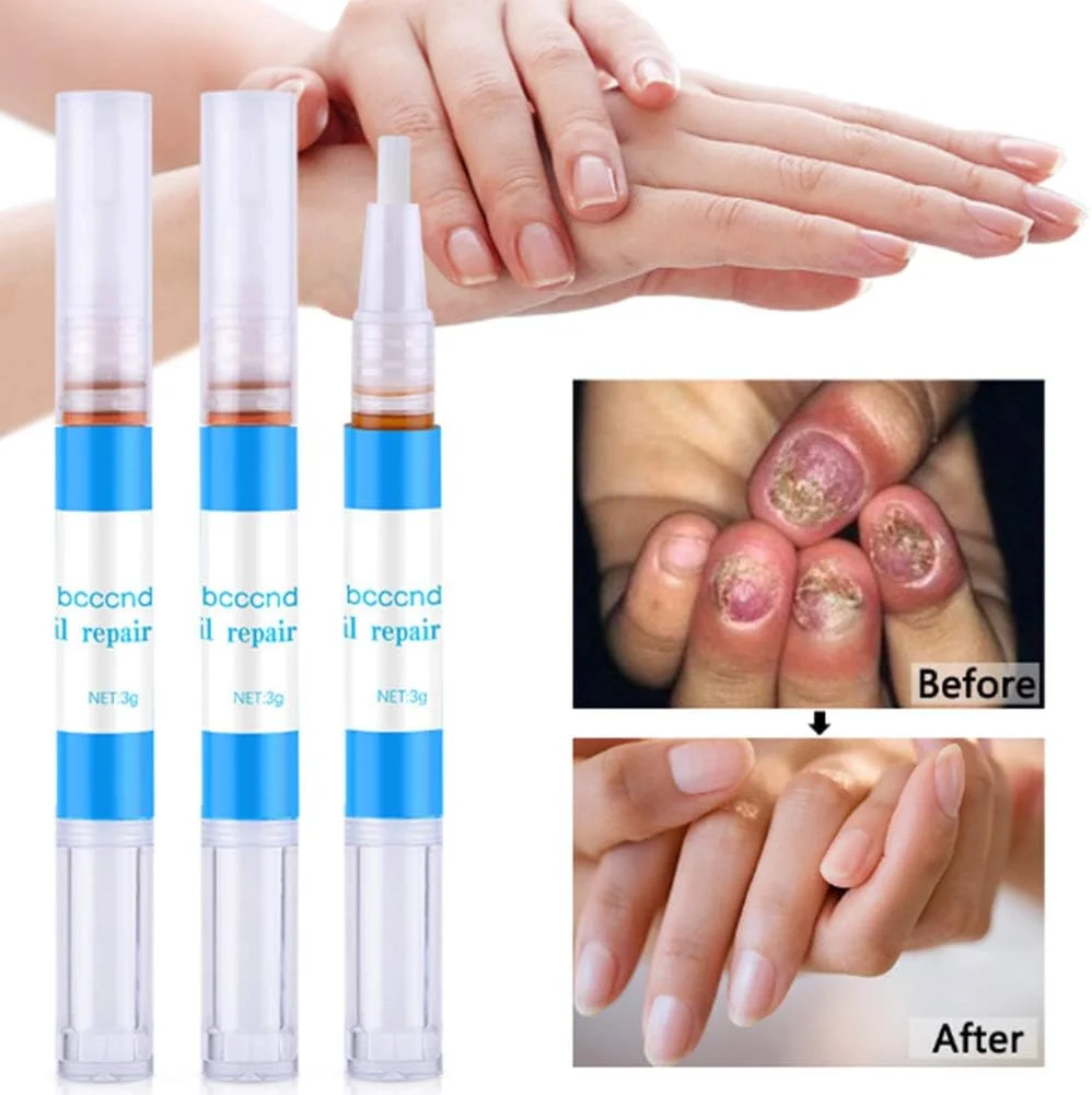 قلم محلول مراقبت از ناخن، 3 عدد، درمان حداکثر قدرت ضد قارچ ناخن پا برای مراقبت از ناخن های ترک خورده، زبر، شکننده و شکافته شده قلم محلول مراقبت از ناخن، 3 عدد، درمان حداکثر قدرت ضد قارچ ناخن پا برای مراقبت از ناخن های ترک خورده، زبر، شکننده و شکافته شده
