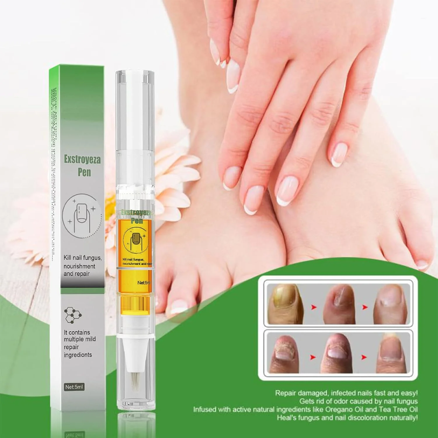 محلول مراقبت از ناخن، ترمیم کننده ناخن، محلول ضد قارچ ناخن 5 میلی لیتر