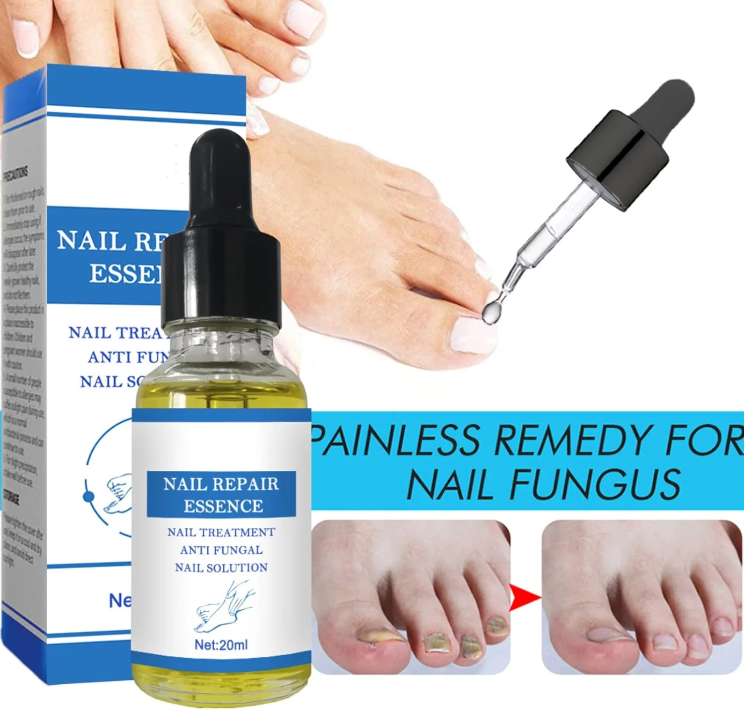 محلول درمان قارچ ناخن پا، درمان قارچ ناخن، ضد قارچ ناخن پا، ترمیم ناخن محلول درمان قارچ ناخن پا، درمان قارچ ناخن، ضد قارچ ناخن پا، ترمیم ناخن