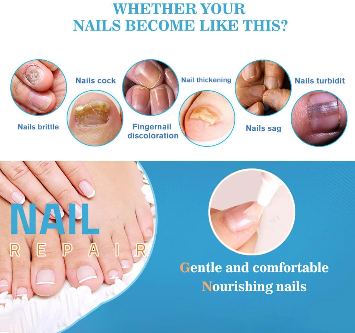 قلم درمان ناخن، قلم ترمیم ناخن، درمان ناخن، محلول ضد قارچ ناخن - از بین برنده قارچ ناخن پا و ناخن انگشت، ضد قارچ قلم درمان ناخن، قلم ترمیم ناخن، درمان ناخن، محلول ضد قارچ ناخن - از بین برنده قارچ ناخن پا و ناخن انگشت، ضد قارچ