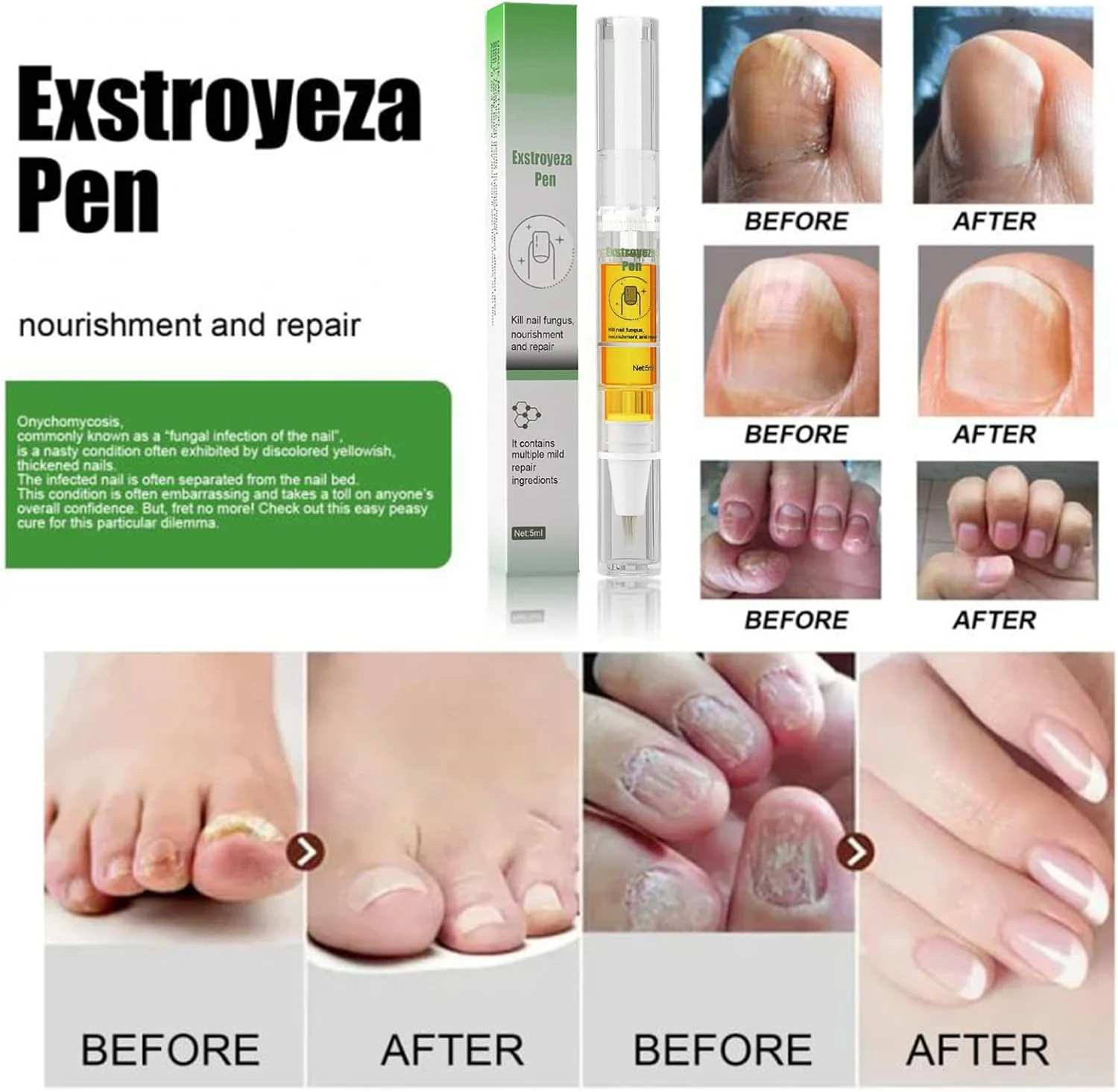 محلول مراقبت از ناخن، ترمیم کننده ناخن، محلول ضد قارچ ناخن 5 میلی لیتر