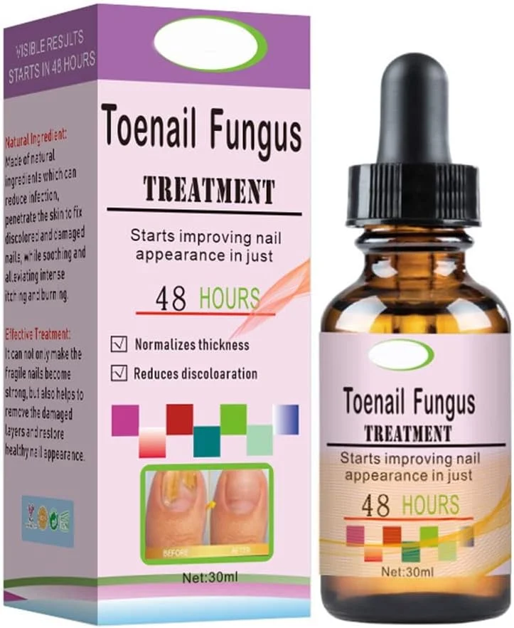 محلول طبیعی درمان قارچ ناخن پا، درمان قارچ ناخن، محلول قوی ضد قارچ ناخن پا، ترمیم ناخن، اسانس درمان ناخن