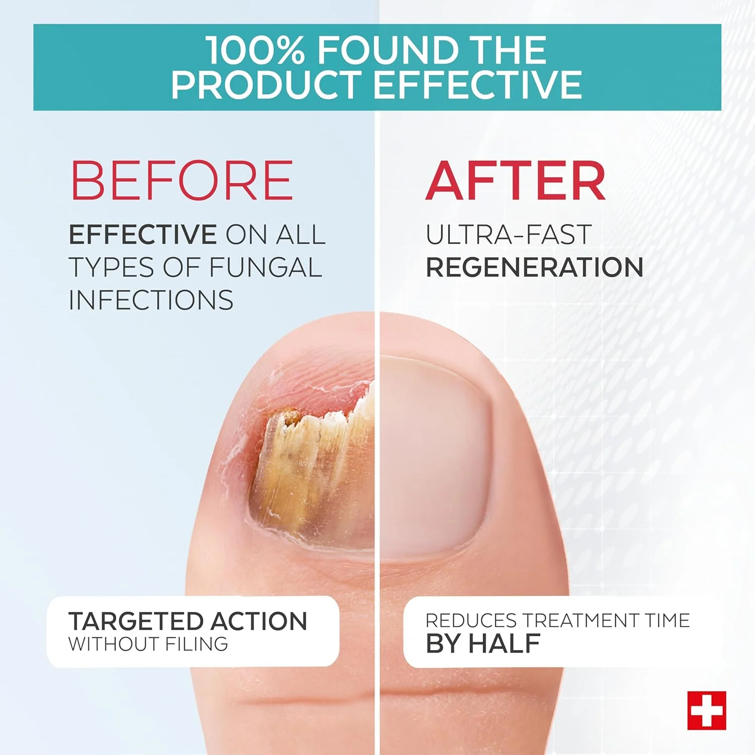 پودرم - بسته 2 عددی محصولات عفونت قارچی شدید - درمان جامع ویژه برای عفونت های قارچی مقاوم به درمان - درمان حرفه ای پا/دست - سریع و آسان - ساخت سوئیس پودرم - بسته 2 عددی محصولات عفونت قارچی شدید - درمان جامع ویژه برای عفونت های قارچی مقاوم به درمان - درمان حرفه ای پا/دست - سریع و آسان - ساخت سوئیس
