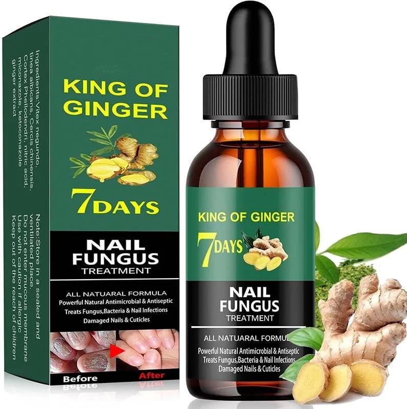 محلول درمان قارچ ناخن پا، محلول قوی ترمیم ناخن حاوی عصاره زنجبیل، ترمیم موثر ناخن های آسیب دیده و تغییر رنگ یافته