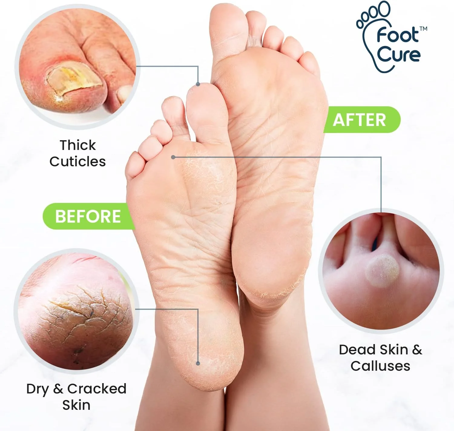 مجموعه درمان قارچ ناخن پا اکسترا قوی FOOT CURE - محلول خیساندن، قلم ترمیم کننده و بالم درخت چای - مجموعه ای عالی برای بوی بد پا، ترک خوردگی و تغییر رنگ قارچی ناخن - ساخت آمریکا مجموعه درمان قارچ ناخن پا اکسترا قوی FOOT CURE - محلول خیساندن، قلم ترمیم کننده و بالم درخت چای - مجموعه ای عالی برای بوی بد پا، ترک خوردگی و تغییر رنگ قارچی ناخن - ساخت آمریکا
