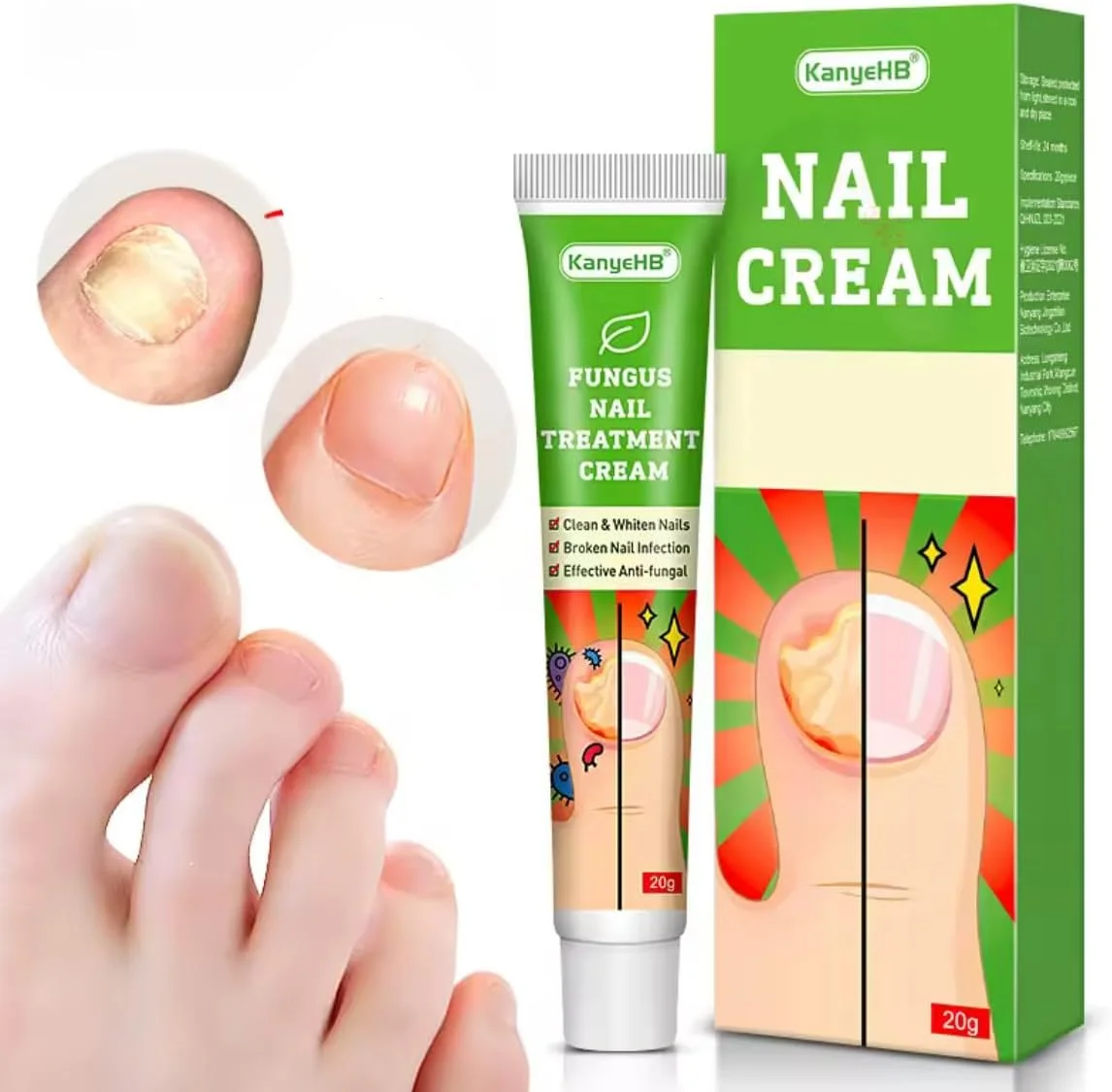 کرم درمان ناخن قارچی، فرمول ضد قارچ برای ناخن های پا، تمیز کننده و سفید کننده ناخن ها، مراقبت از عفونت ناخن شکسته کرم درمان ناخن قارچی، فرمول ضد قارچ برای ناخن های پا، تمیز کننده و سفید کننده ناخن ها، مراقبت از عفونت ناخن شکسته