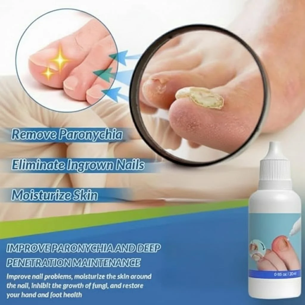 روغن مراقبت پیشرفته ناخن فرورفته نالاکال، ترمیم کننده قوی قارچ ناخن و درمان کوتیکول، تسکین دهنده ناخن های آسیب دیده روغن مراقبت پیشرفته ناخن فرورفته نالاکال، ترمیم کننده قوی قارچ ناخن و درمان کوتیکول، تسکین دهنده ناخن های آسیب دیده