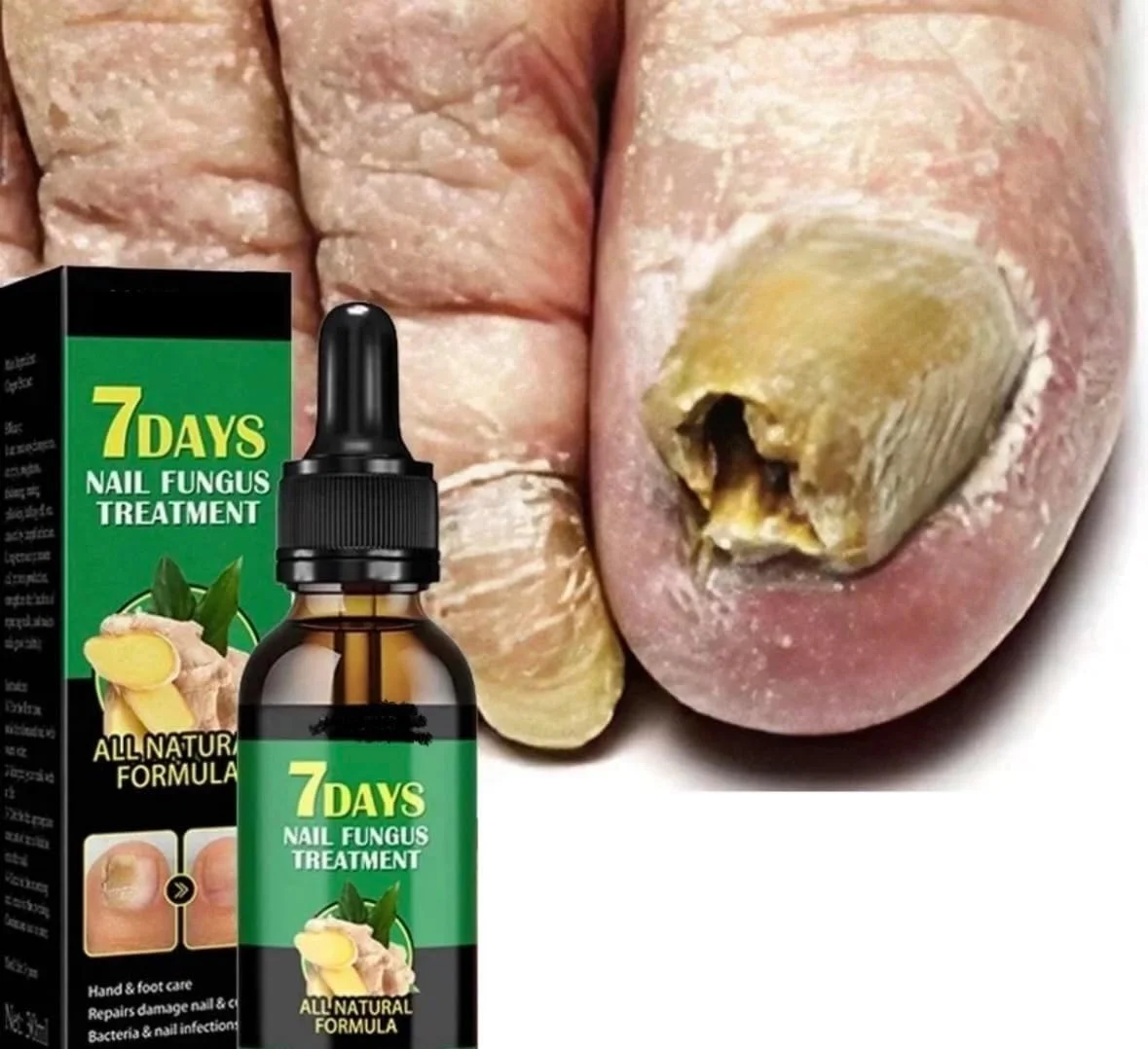 محلول مراقبت از ناخن 7 روزه، فرمول کاملا طبیعی، محلول مایع برای مراقبت از دست و پا