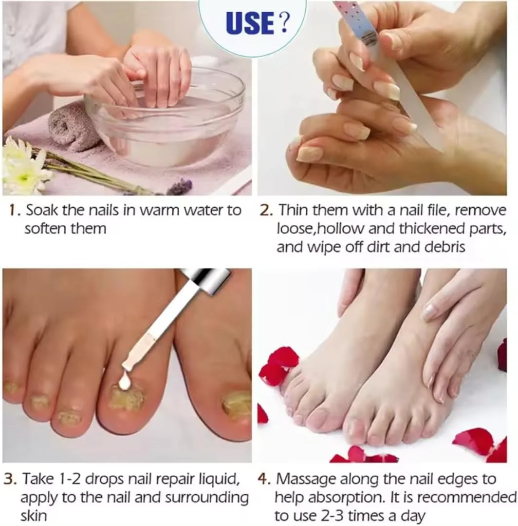 مایع درمان ناخن آسیب دیده NIKITA.VIVI | مایع ترمیم ناخن 7 روزه برای ناخن های پا و دست آسیب دیده | ترمیم کننده ناخن، صاف کننده، مرطوب کننده، کاهش تغییر رنگ ناخن 20 میلی لیتر مایع درمان ناخن آسیب دیده NIKITA.VIVI | مایع ترمیم ناخن 7 روزه برای ناخن های پا و دست آسیب دیده | ترمیم کننده ناخن، صاف کننده، مرطوب کننده، کاهش تغییر رنگ ناخن 20 میلی لیتر