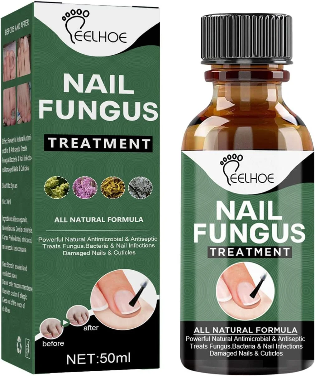 محلول درمان قارچ ناخن گرافسوآ 50 میلی لیتر، حاوی عصاره های گیاهی، از بین برنده اونیکومایکوزیس، بدون آسیب رساندن به ناخن، بازگرداندن درخشش و ترمیم ناخن