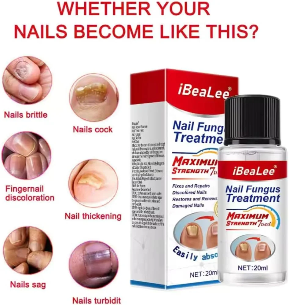 مایع درمان ناخن آسیب دیده NIKITA.VIVI | مایع ترمیم ناخن 7 روزه برای ناخن های پا و دست آسیب دیده | ترمیم کننده ناخن، صاف کننده، مرطوب کننده، کاهش تغییر رنگ ناخن 20 میلی لیتر مایع درمان ناخن آسیب دیده NIKITA.VIVI | مایع ترمیم ناخن 7 روزه برای ناخن های پا و دست آسیب دیده | ترمیم کننده ناخن، صاف کننده، مرطوب کننده، کاهش تغییر رنگ ناخن 20 میلی لیتر