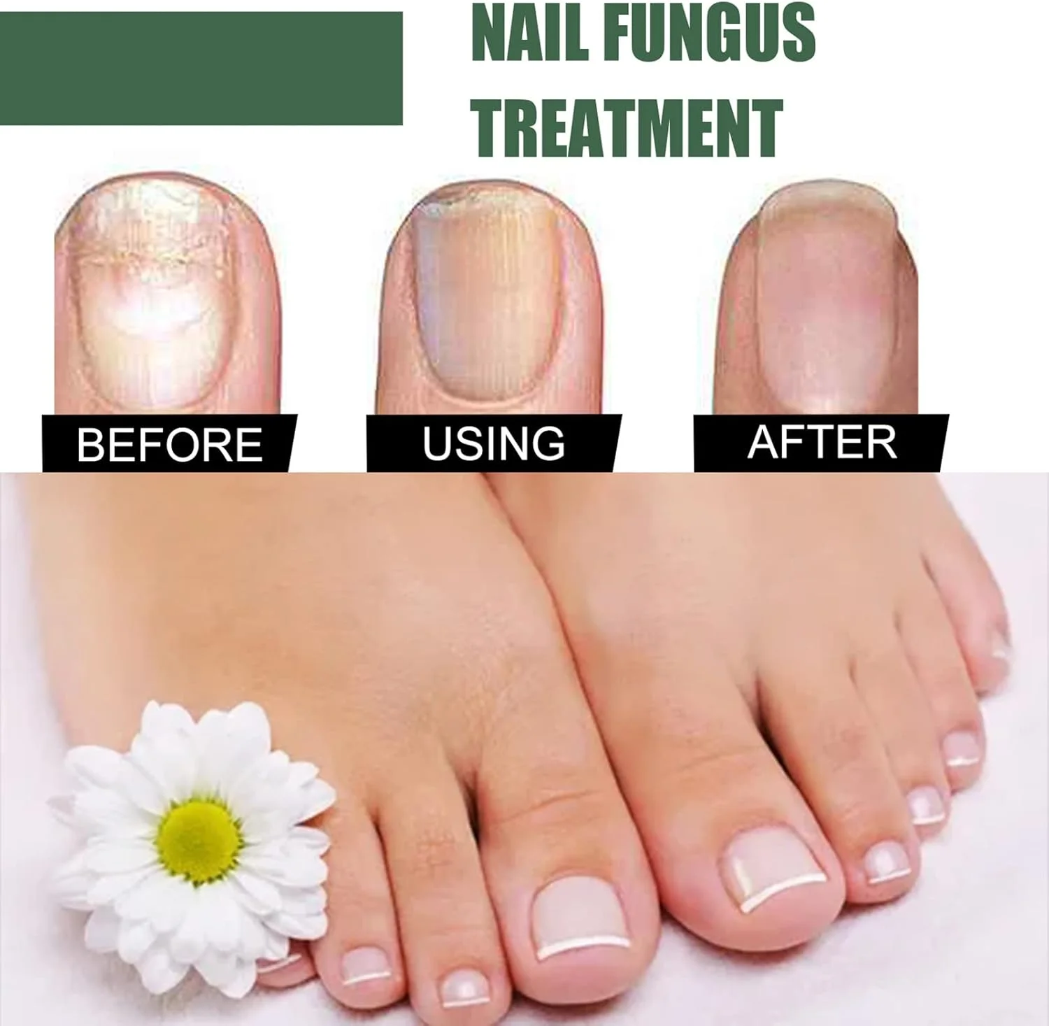 محلول درمان قارچ ناخن گرافسوآ 50 میلی لیتر، حاوی عصاره های گیاهی، از بین برنده اونیکومایکوزیس، بدون آسیب رساندن به ناخن، بازگرداندن درخشش و ترمیم ناخن محلول درمان قارچ ناخن گرافسوآ 50 میلی لیتر، حاوی عصاره های گیاهی، از بین برنده اونیکومایکوزیس، بدون آسیب رساندن به ناخن، بازگرداندن درخشش و ترمیم ناخن