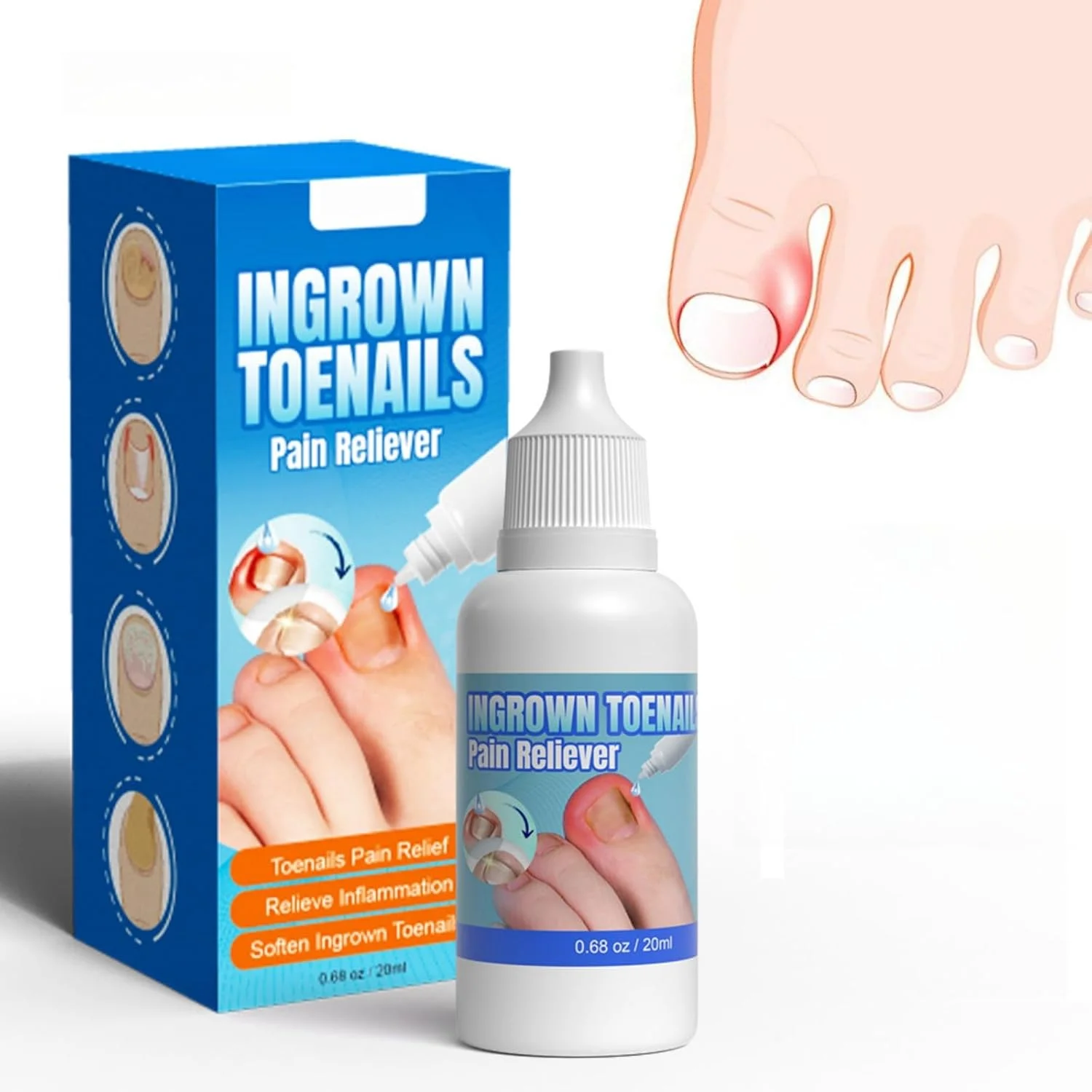 مایع ترمیم ناخن فرورفته HONPOLO، 20 میلی لیتر، محلول ضد قارچ، فرمول مرطوب کننده برای نرم کردن پوست، احیا و ترمیم ناخن های آسیب دیده