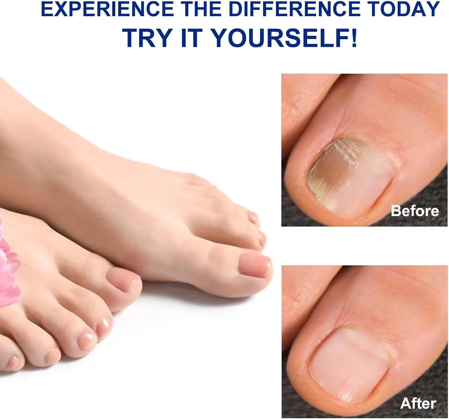 ۳۲ عدد پد درمان قارچ ناخن، پد قوی برای ناخن های قارچی | پد ناخن قارچی با قابلیت استفاده ۸ ساعته در طول شب | پد پا | ترمیم قوی برای قارچ ناخن | استیکر ترمیم ناخن پا